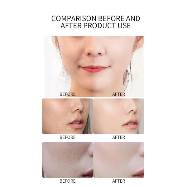 Black Spot Peptide Hyaluronic Vitamin C Serum Essence Facial Whitening Custom