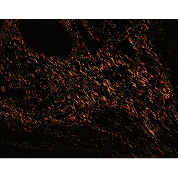 Laboratory 2x20ml Picrosirius Red Stain Kit For Healthcare Facility