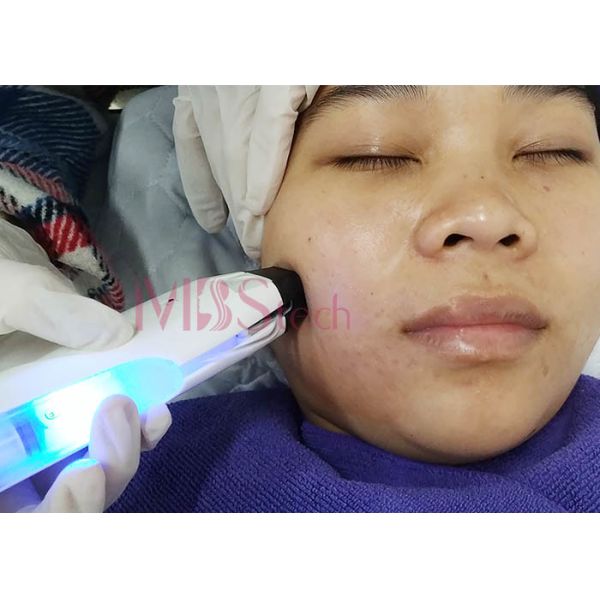Skin Rejuvenation Face Lifting Thermagic Microneedle RF Machine