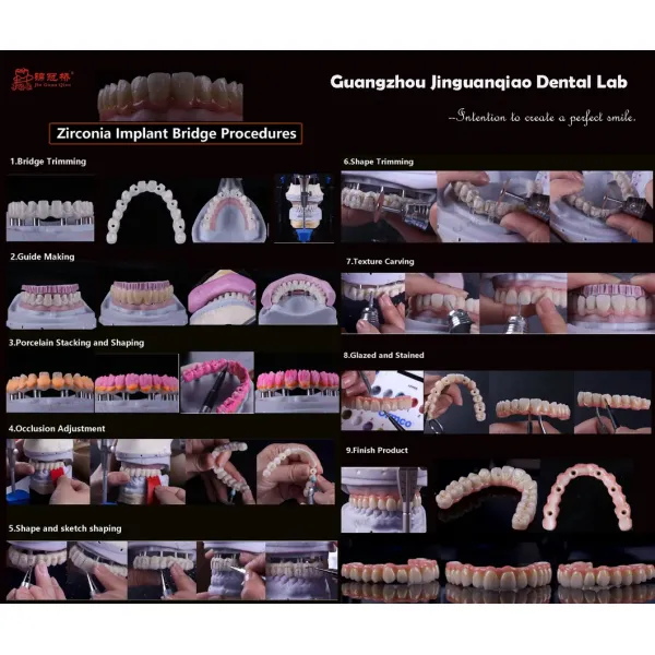 3D Printer Zirconia Crown and Bridge Hybrid Dental Implant with Titanium Abutment