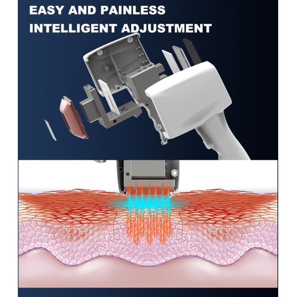 buy laser hair removal device