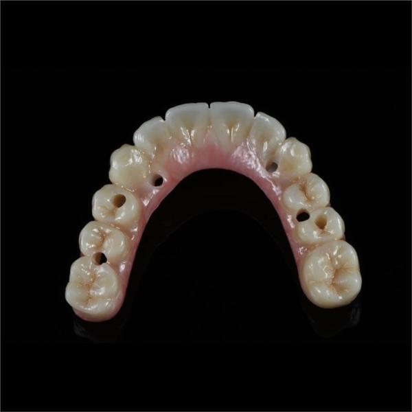 Fixed Restorations Full Arch Zirconia Implant Bridge Denture Teeth