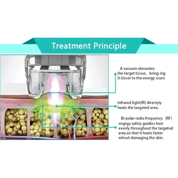 CE approval anti-aging body slimming beauty equipment rf vacuum roller massage machine