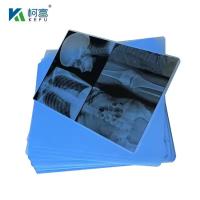 A4 encre médicale Jet film bleu X-ray PET film papier X-ray