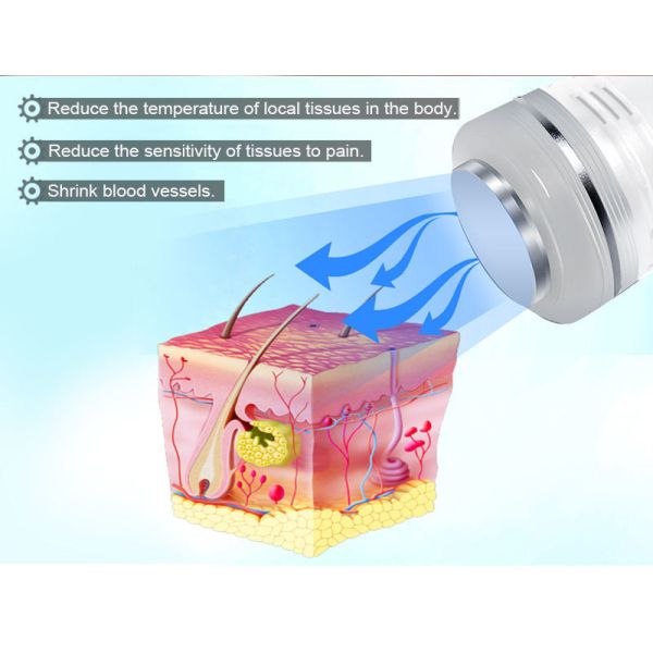 машина удаления машины удаления Varicose вены 40W 980nm высокочастотная васкулярная