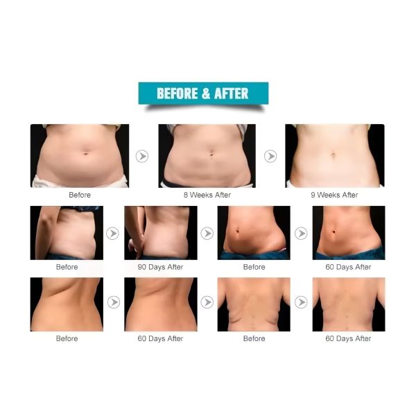 RF BIO Body Shaping Machine 6 In 1 80k Cavitation Slimming Machine
