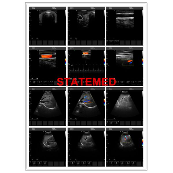 96 E 3d Ultrasound Equipment 15 Inch Monitor / 4D Medical Ultrasound Machine