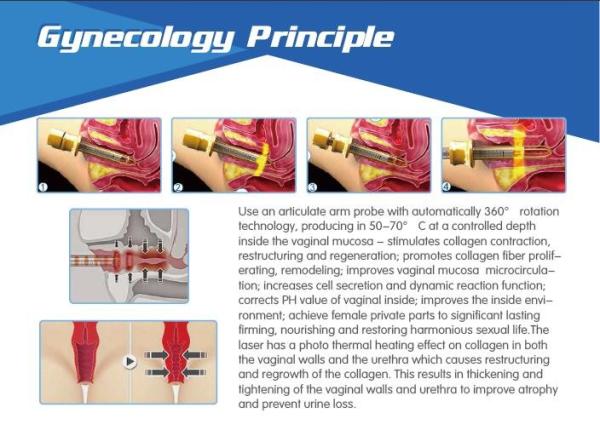 most advanced 30w power USA Coherent laser vertical fractional co2 laser with vaginal tightening