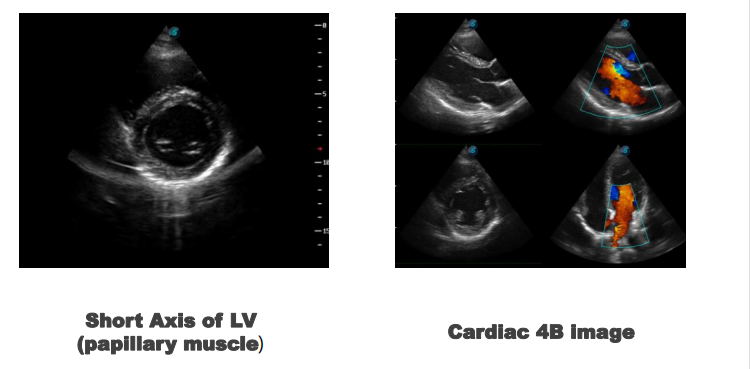 Stock SonoScape S22 ultra 5G Ultrasound Machine, Wireless Ultrasound for Veterinary Ultrasound Diagnosis