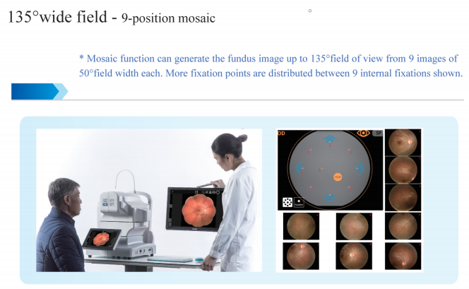 Ультра широким тип автоматизированный полем Fundus камеры оборудование фотографии b с FFA