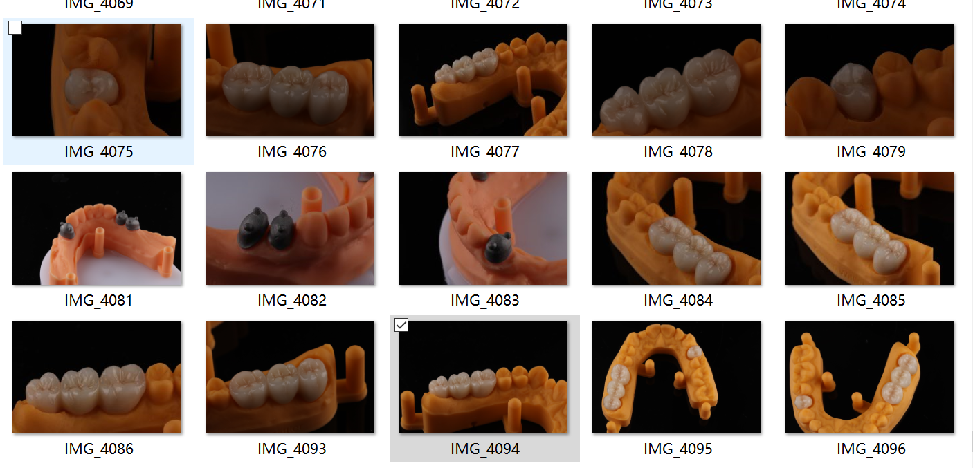 Be Ni Free Металлические Порцелановые Короны Точное Эстетическое PFM Корона Зубная