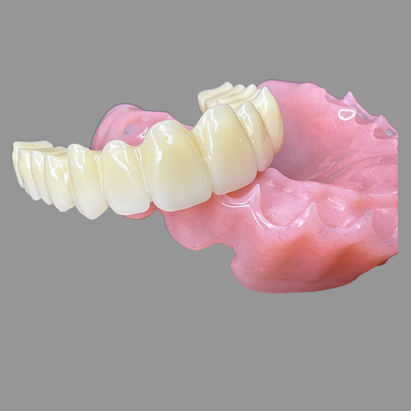 CAD/CAM Digital Milled Acrylic Base Denture Removable