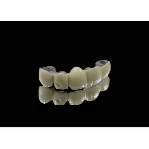 Premium Quality Dental Product Porcelain-Fused-to-Metal (PFM) Crowns
