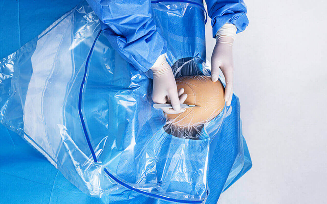Медицинский стерильный Craniotomy задрапировывает хирургическое с апертурой 1pc/мешком