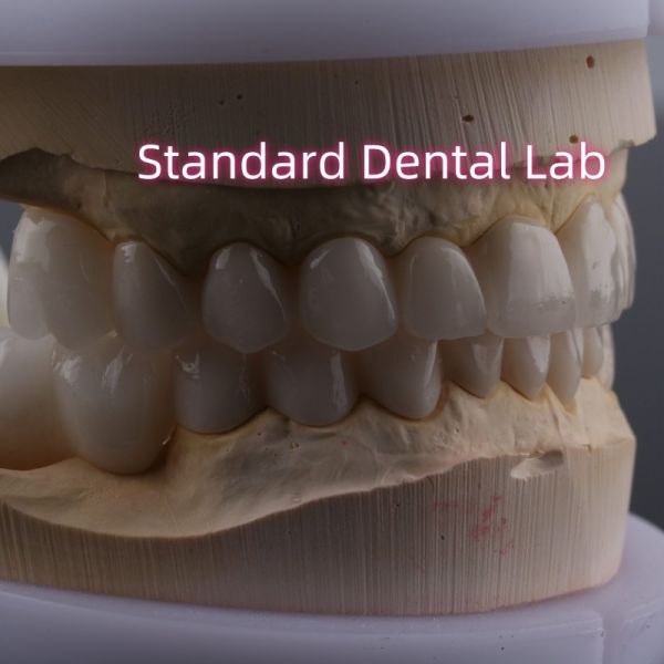 Laboratorio dental Arco completo de zirconia Coronas de porcelana PFZ Corona ISO FDA CE