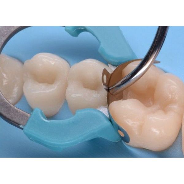 Stainless Steel Palodent Matrix Systems For Restorative Dentistry Metal Matrices