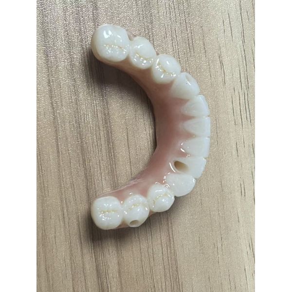 Monolithic Zirconia Implant Bridge for Full Arch Restoration with CAD/CAM Precision