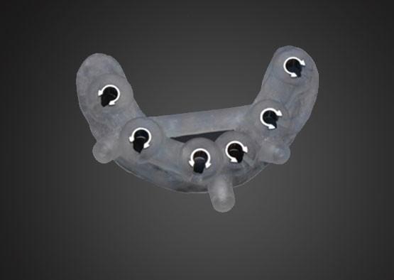 Surgical sguide Plan for Implant Supported Crown Design and Alveolar Bone Information