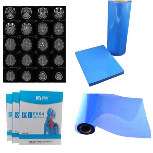 CT Scanner Dry X-ray A3 / A4 Medical Ink Jet Blue Film X-ray PET Film