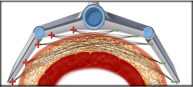 Non - Surgical Fat Reduction RF Cavitation Slimming Machine 27.12MHZ