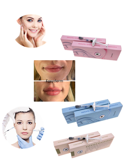 Заполнитель Lidocaine Hyaluronic кисловочный вводимый дермальный для губы стороны