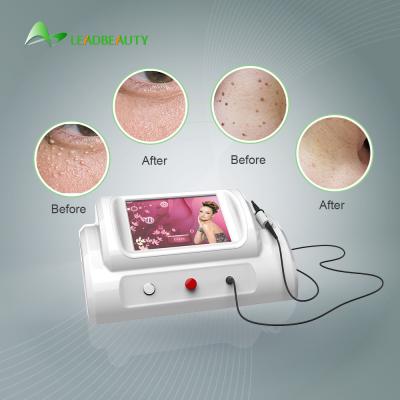 30Mhz high frequency Spider Vein removal price / using for vascular removal with 8.4 inch screen /150W skin tag removal