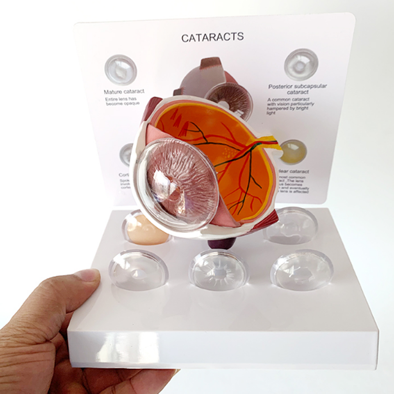 Human Eyeball Cataract Anatomy Medical Science Human Eye Anatomy Model