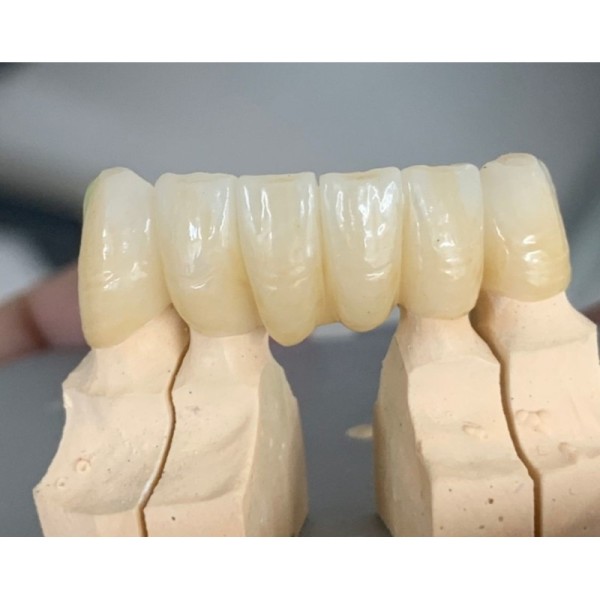 Zirconia Block 98 mm 3D Multilayer Yucera Dental Laboratory  Zirconio Multilayer Dentale Zirconia Block CAD CAM