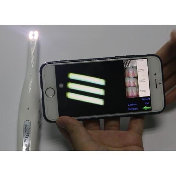 Wi-Fi Intraoral Camera Digital Video Otoscope Camera Tooth Camera with Wi-fi Connected to Mobilephone