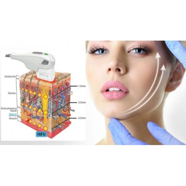 La máquina de la belleza de Hifu de la cara, el ultrasonido enfocado de intensidad alta Hifu hace frente a la máquina de la elevación