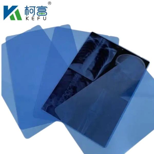 Blue Film Inkjet X Ray Printing 8''*10'' Sheet PET Inkjet Blue Film Medical Dry X-ray Film