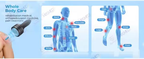 Dispositivo de terapia de ondas de choque enfocado FSWT profesional, maleta veterinaria, máquina de ondas de choque enfocadas para el alivio del dolor y la regeneración de tejidos
