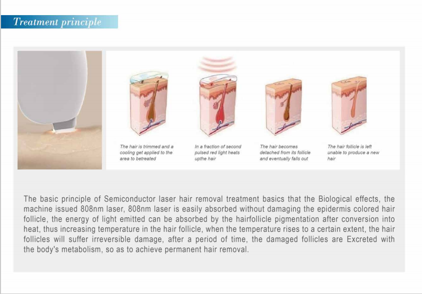 Portable diode laser hair removal machine