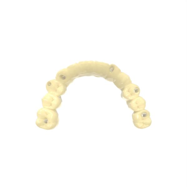 Ultra High Resistance Bridge Resin Temporary Crown Dental 3d Printing Resin