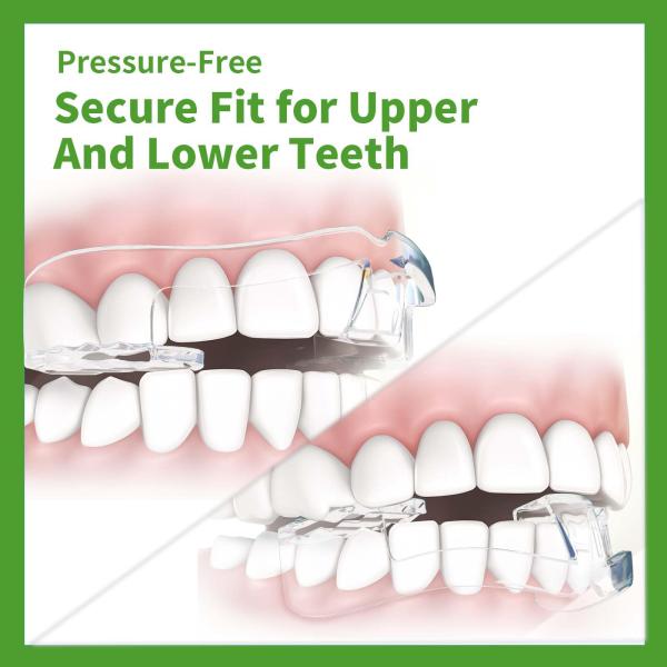 Adult Mouth Guard Prevent Grinding Teeth 10 Pack Night Guards For Teeth 