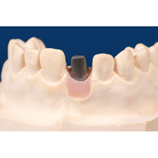 Sandblasted Titanium Custom Abutment Rectangular Implant Custom Abutment