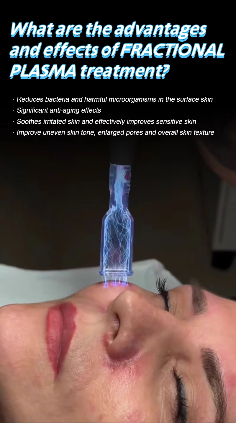 Cool Plasma Machine For Wrinkle Removal Skin Rejuvenation Body Care
