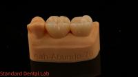 Des couronnes de laboratoire dentaire 3D Pro haute translucide couronnes en zirconium complet avec garantie de 5 ans