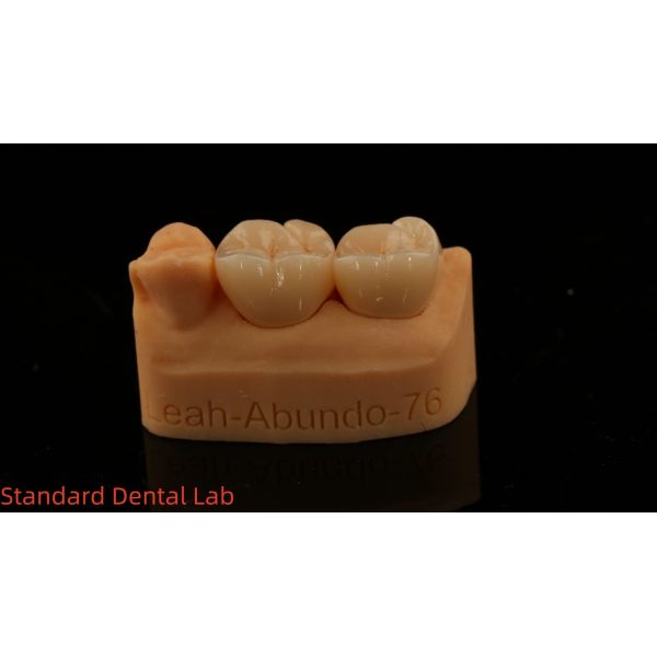 Solid Dental Lab Crowns 3D Pro High Translucency Full Zirconia Crowns with 5-Year Guarantee