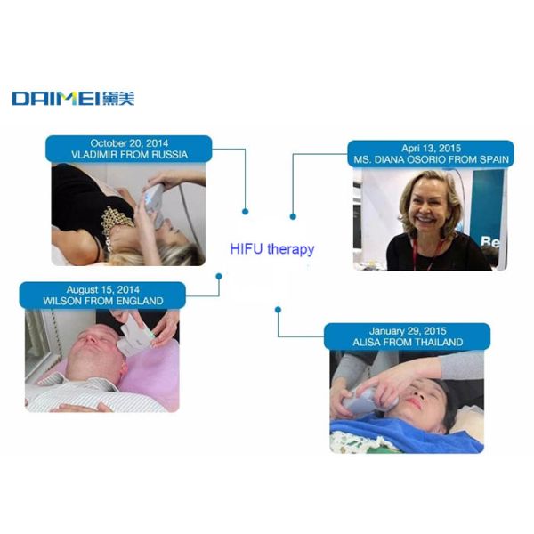 High Intensity Focused HIFU Equipment 400w With 10000 Shots Per Cartridge