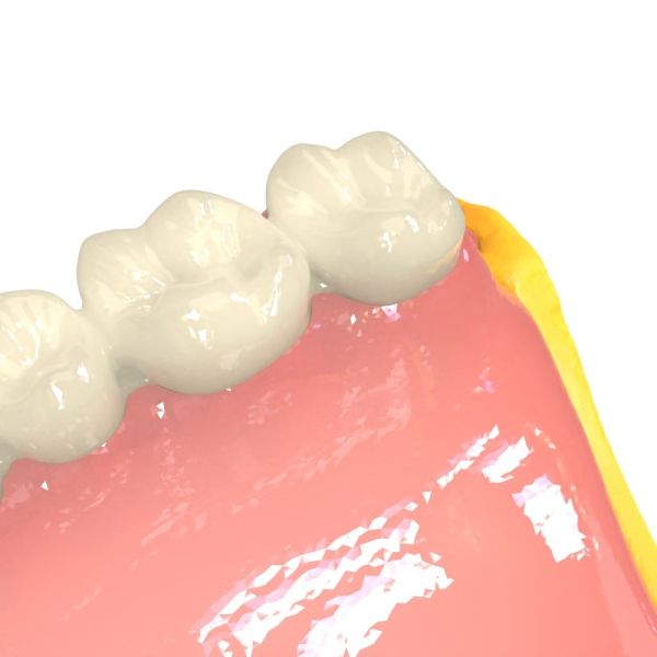 Résine 3D biocompatible