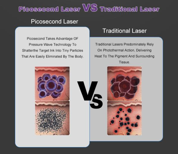 Laser Beauty Equipment Professional Pico Picosecond Machine Q Switched Nd Yag Laser Tattoo Removal Machine