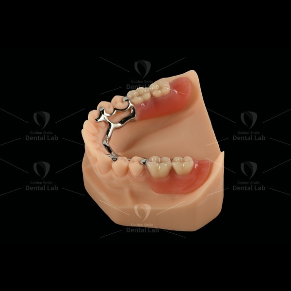Lightweight Cobalt Chrome Partial Denture Framework Clasp Flexible Acrylic Partial Denture
