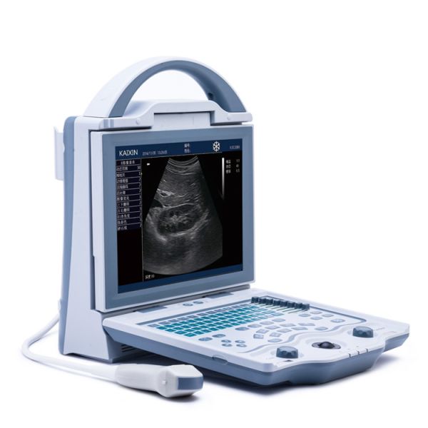 Diagnostic Medical Ultrasound Machine KX5600 Ultrasound Machine Full Digital B Mode