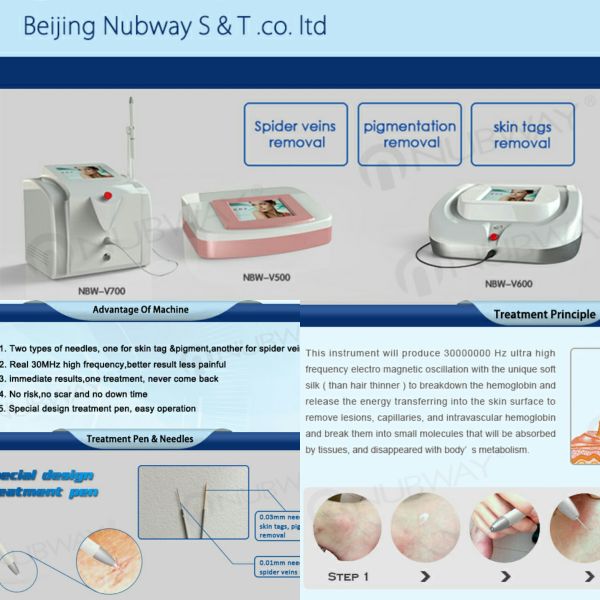 Professional 2016 newest spider vein removal machine! laser varicose vein removal