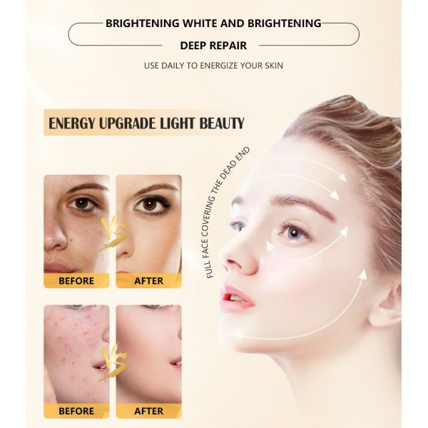 Ions Operation System High Energy Led Smart Facial Skincare and Mask Therapy Light Red