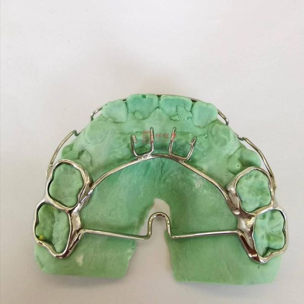 Customized Orthodontic Dental Retainer 3D Laser Printing CE/FDA Certified