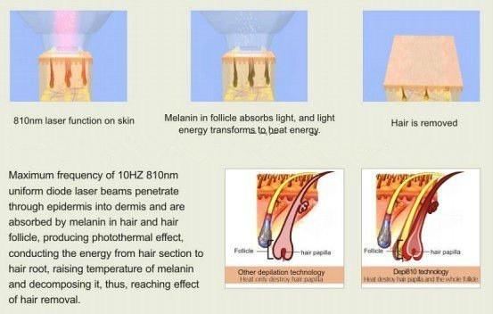 Promotion!!! Newest designed light sheer diode laser hair removal machine for spa / clinic
