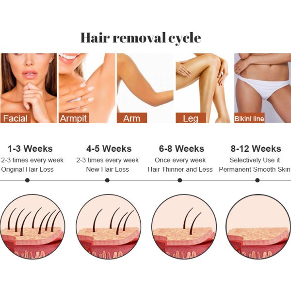 Диодная лазерная удаление волос 800 Вт 755 нм 1064 нм 808 нм трио лазерная машина