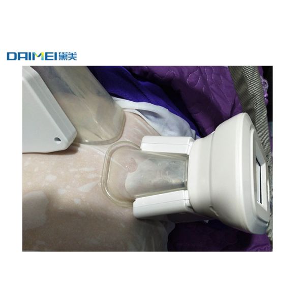 Cavitation Body Slimming Machine , Cryolipolysis Vacuum Machine For Skin Tightening